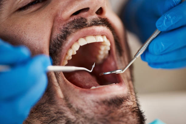Emergency Gum Pain Relief in WI