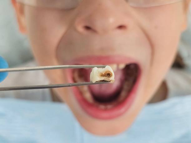 Best Tooth Pain Emergency Relief  in Howard, WI
